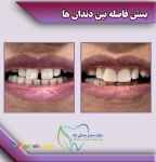 مرکز دندانپزشکی زیبایی و ایمپلنت بزرگسالان