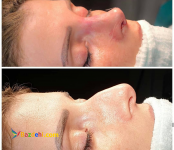 دکتر بهزاد خوش رفتار جراح و متخصص گوش حلق بینی و زیبایی بینی با 15 سال سابقه درخشان ?