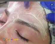 مزووایت(کرم پودر دایم)