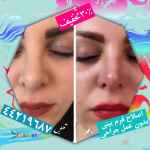 پوست و مو و زیبایی