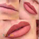 میکروبلیدینگ و میکروپیگمنتیشن سارا