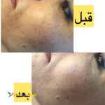 آموزش و ارائه خدمات مراقبت از پوست ( skincare)