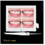 فروش اقساطی تجهیزات دندانپزشکی بدون بهره