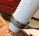 لیفت و رفع چروک و افتادگی پوست با آر-اف 