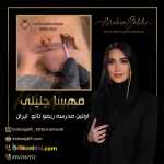 ریموو تاتو بدون لیزر و با بهترین مواد ریموور 