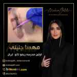 ریموو ابرو تخصصی با بهترین روش های پاک کردن تاتو