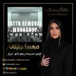 آموزش ریموو تاتو کک و مک با مهسا جلیلی به صورت اصولی