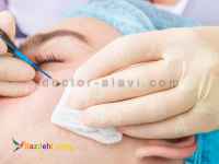 لیزر ضایعات پوستی و تاتو