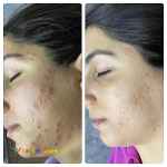 فیشیال تخصصی پوست دادمان