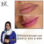 آموزش ریموو تاتو خط لب با بهترین روش ها