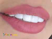 مركز دندانپزشكي لبخند