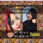 جراحی عمل بینی زیبایی رخ نو زیبا دکتر نوروزی مشاور صالحی